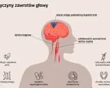Zablokowanie tętnicy szyjnej lub kręgowej może prowadzić do niedotlenienia mózgu, powodując zawroty głowy. Inne przyczyny to choroby mózgu, ucha, zaburzenia metaboliczne, sercowo-naczyniowe, leki i układu przedsionkowego.