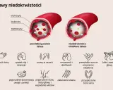Niski poziom żelaza prowadzi do niedokrwistości, objawiającej się bladością skóry, zmęczeniem, szumami w uszach i bólami głowy.
