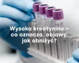 Rękawiczka laboratoryjna trzyma probówki. Tekst: "Wysoka kreatynina – co oznacza, objawy, jak obniżyć?".