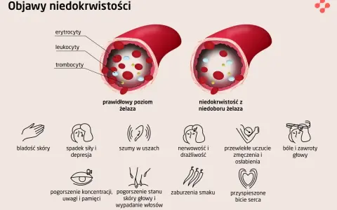 Niski poziom żelaza prowadzi do niedokrwistości, objawiającej się bladością skóry, zmęczeniem, szumami w uszach i bólami głowy.