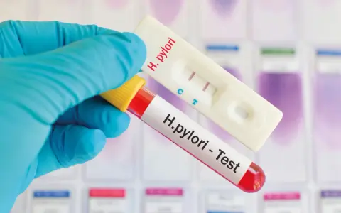 Rękawiczka trzyma probówkę z krwią i test kasetkowy. Dwa paski na teście wskazują, że test ureazowy dodatni.