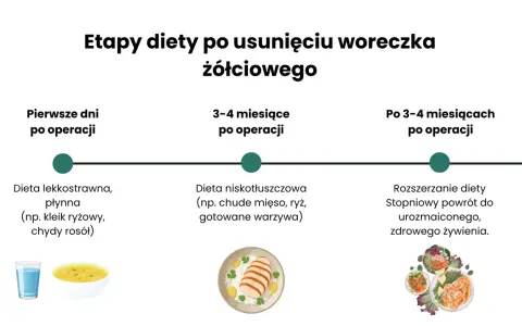 Etapy diety po usunięciu woreczka żółciowego: lekkostrawna, niskotłuszczowa, a potem powrót do zdrowego żywienia.