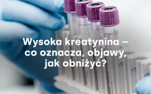 Rękawiczka laboratoryjna trzyma probówki. Tekst: "Wysoka kreatynina – co oznacza, objawy, jak obniżyć?".